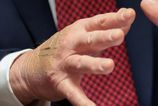 Biely dom vysvetluje naplaste na ruke Trumpa